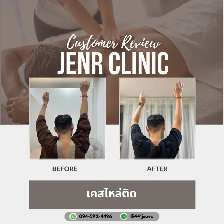 Jenr Clinic นวดแก้ไหล่ติด