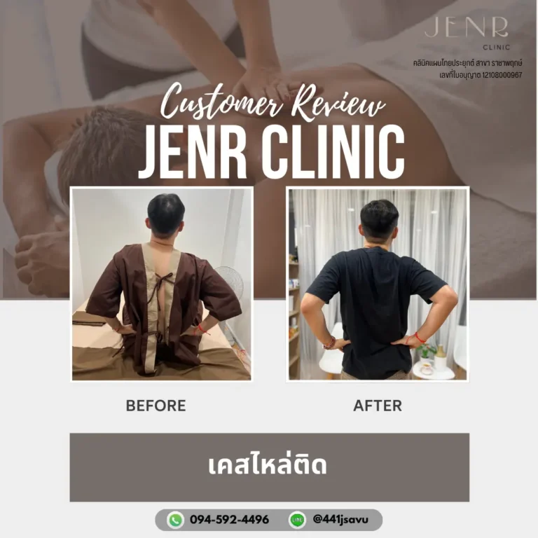 Jenr Clinic นวดแก้ไหล่ติด