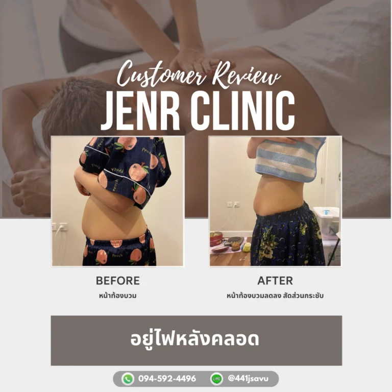 อยู่ไฟหลังคลอด