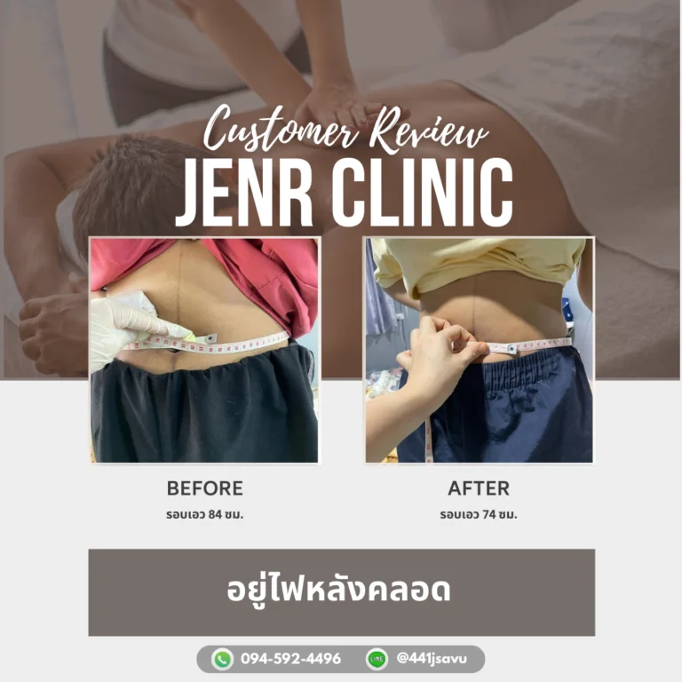 อยู่ไฟหลังคลอด