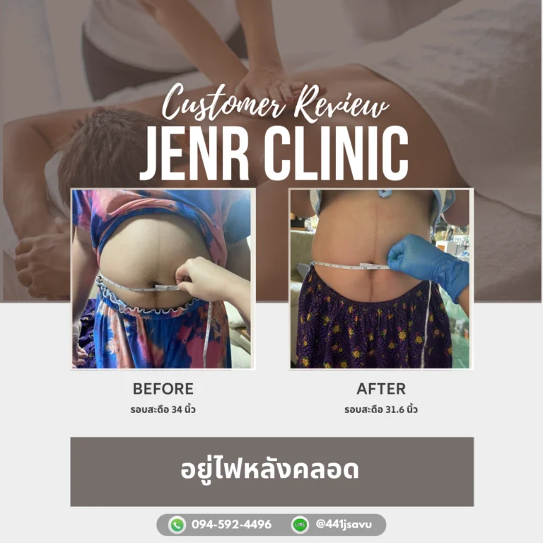 อยู่ไฟหลังคลอด